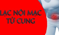 Lạc nội mạc tử cung có triệu chứng gì?