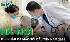 Ghi nhận ca mắc bệnh sởi tại Hà Nội