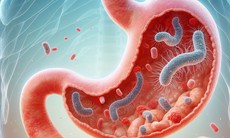 Nhiễm vi khuẩn HP (H.Pylori) dùng thuốc như thế nào?