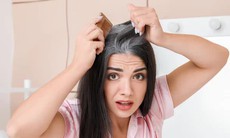 Điều trị tóc bạc sớm theo phương pháp Đông y