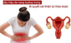 Dấu hiệu đa nang buồng trứng và bí quyết hỗ trợ sức khỏe sinh sản từ thảo dược