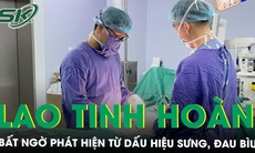 Sưng đau bìu trái, khám phát hiện lao mào tinh hoàn