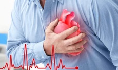 4 thói quen xấu khiến người trẻ dễ bị nhồi máu cơ tim