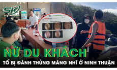 Xác minh vụ nữ du khách tố bị đánh thủng màng nhĩ ở Ninh Thuận