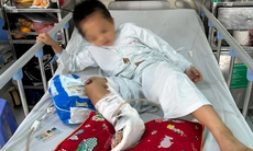 Bé trai dân tộc Mông bị tai nạn ‘nát’ một bên chân cần gấp sự cứu giúp của cộng đồng