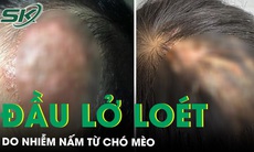 Đầu lở loét chảy dịch do nhiễm nấm từ chó mèo