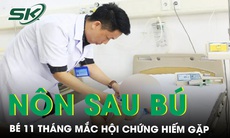 Nôn hoàn toàn sau bú, bé 11 tháng tuổi mắc chứng tắc tá tràng bẩm sinh hiếm gặp 