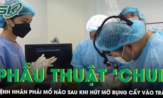 Vụ nguy kịch sau khi hút mỡ bụng cấy vào vùng trán, bác sĩ phẫu thuật ‘chui', bệnh nhân phải mổ não