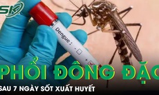 Phổi đông đặc sau 7 ngày sốt xuất huyết