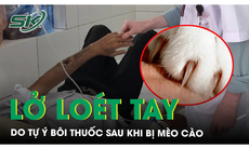 Lở loét ở cánh tay do tự ý bôi thuốc sau khi mèo cào: Bác sĩ cảnh báo nguy cơ