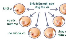 Tại sao tuổi cao trở thành yếu tố nguy cơ của ung thư?