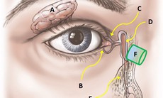 Tắc lệ đạo nên ăn gì để mắt sáng khỏe?