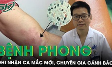 Ghi nhận trường hợp mắc bệnh phong tại Hải Dương, chuyên gia cảnh báo