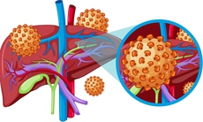 Viêm gan B: Nguyên nhân, triệu chứng, lây truyền, cách điều trị và phòng bệnh