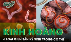 Kinh hoàng người phụ nữ có 6 loại giun sán ký sinh trong cơ thể 