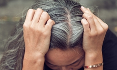 Cách giúp ngăn ngừa tóc bạc sớm hiệu quả