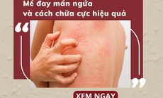 Mề đay mẩn ngứa và cách chữa trị