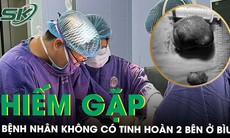 Nam bệnh nhân không có tinh hoàn 2 bên bìu vẫn sinh con