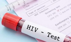 Thêm hy vọng về khả năng chữa khỏi bệnh HIV/AIDS