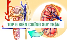 6 biến chứng suy thận và cách hỗ trợ phòng ngừa hiệu quả