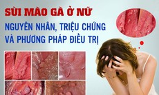 Bệnh sùi mào gà ở nữ giới: Nguyên nhân, dấu hiệu cách chữa