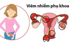 5 nguyên nhân khiến phụ nữ dễ mắc và tái nhiễm bệnh phụ khoa