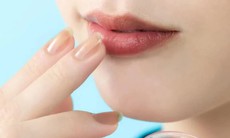 Cách trị môi thâm hiệu quả tại nhà