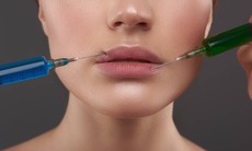 Những lưu ý trước và sau khi tiêm filler môi