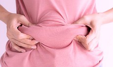 Vì sao phụ nữ dễ tăng cân trong thời kỳ mãn kinh?