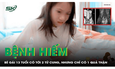 Hiếm gặp: Bé gái 13 tuổi chỉ có một quả thận, 2 tử cung