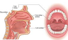 Các phương pháp điều trị viêm VA ở trẻ nhỏ