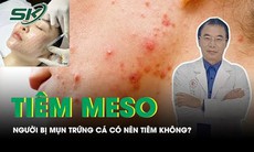 Người đang bị mụn trứng cá có nên tiêm meso không?