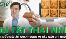 4 mốc siêu âm dị tật thai nhi quan trọng mẹ bầu cần nhớ