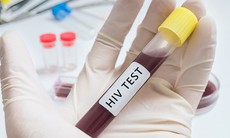 Trường hợp nào nên xét nghiệm HIV?