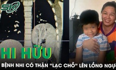 Hi hữu bệnh nhi có thận “lạc chỗ” lên lồng ngực 