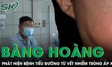 Nhiễm trùng áp xe má phải, bệnh nhân 23 tuổi bàng hoàng phát hiện mắc đái tháo đường