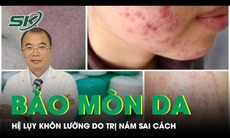 Cảnh báo da bị bào mòn vì trị nám sai cách