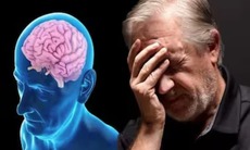 Thêm liệu pháp mới trị bệnh Alzheimer