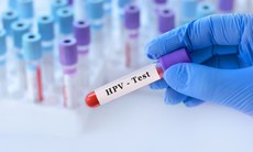 Xét nghiệm HPV dương tính có mắc ung thư cổ tử cung?