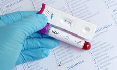 Giải pháp nào cho điều trị đồng nhiễm HIV/viêm gan C?