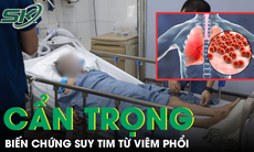 Không chủ quan với bệnh viêm phổi dẫn đến biến chứng suy tim