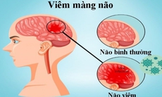 Thuốc điều trị viêm màng não mủ