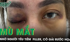 Mù mắt vì nhờ người yêu tiêm filler 