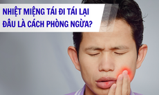 Nhiệt miệng tái lại thường xuyên, làm thế nào để ngăn ngừa?