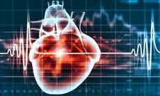 4 điều cần biết để phòng thiếu máu cơ tim