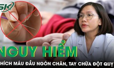 Nguy cơ từ cấp cứu đột quỵ kiểu lang băm bằng chích máu đầu ngón tay