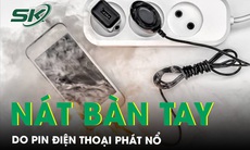 Dập nát bàn tay do pin điện thoại phát nổ