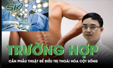 Trường hợp nào cần phẫu thuật để điều trị thoái hóa cột sống