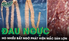 Đau ngực, ho nhiều và chảy nước mũi bất ngờ phát hiện mắc sán lợn