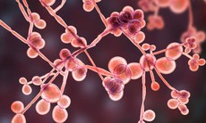 Bệnh nấm Candida: Nguyên nhân, triệu chứng, điều trị và cách phòng ngừa